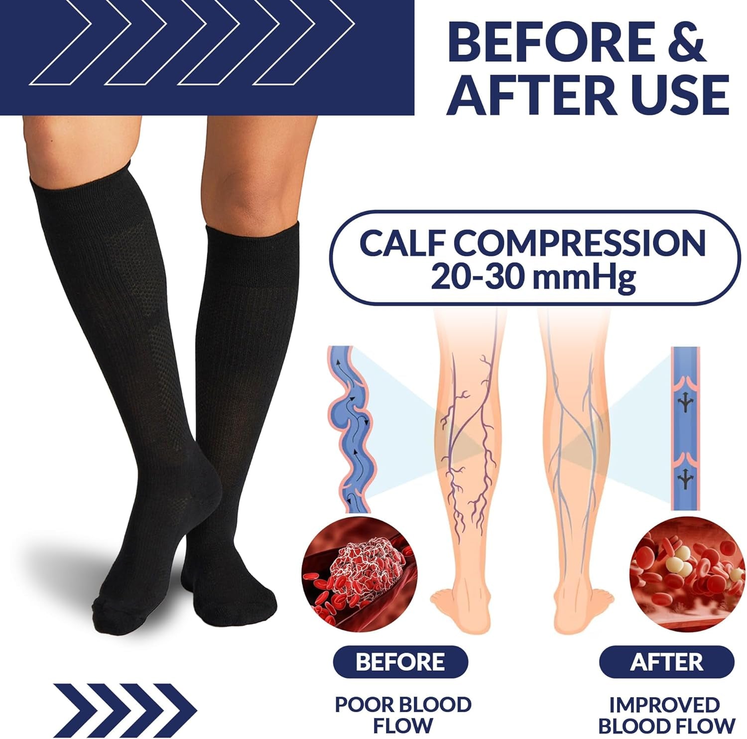 Compression Socks (20-30Mmhg) for Men & Women – Best Compression Socks for All Day Wear, Better Blood Flow, Swelling!